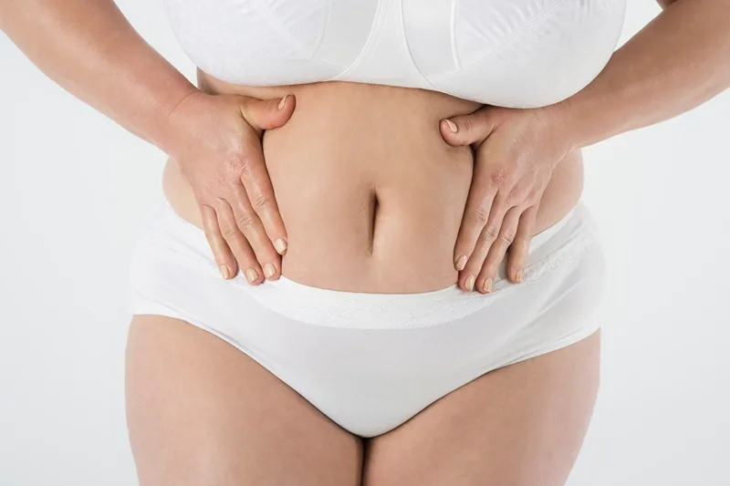 Abdominoplastia