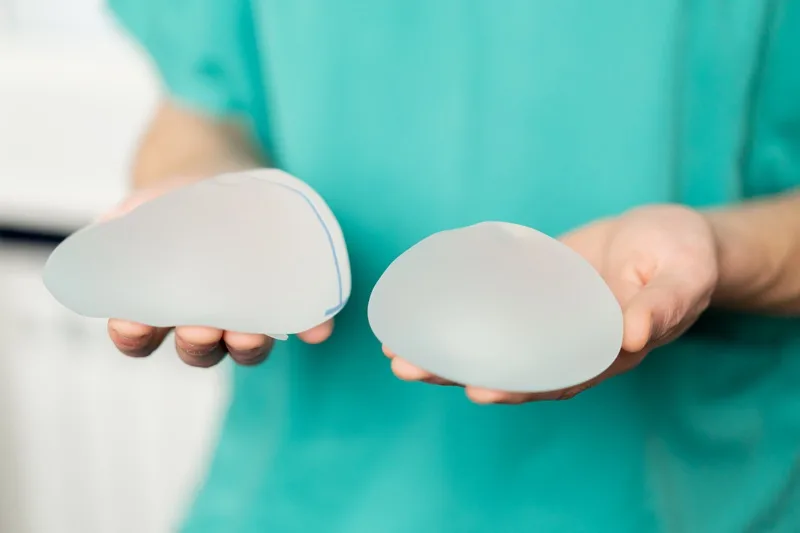 Cambio o retiro de implantes
